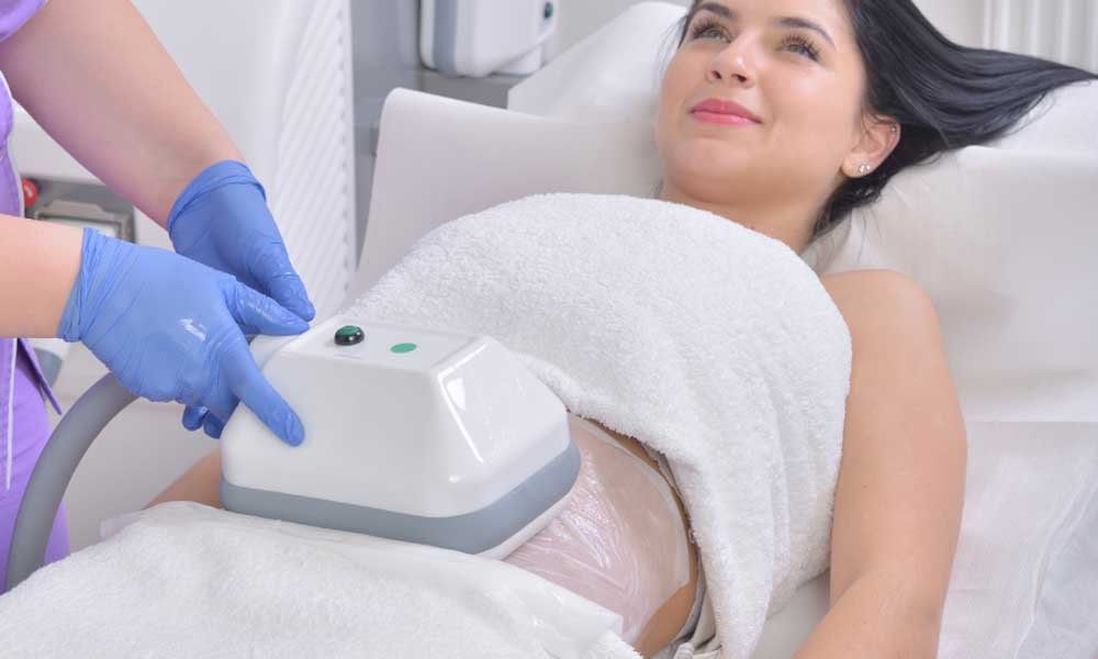 Does CoolSculpting Have Side Effects