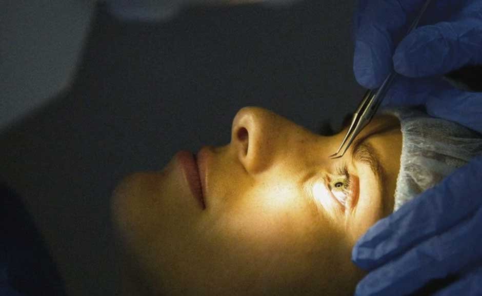 Laser Eye Surgery Correct Vision